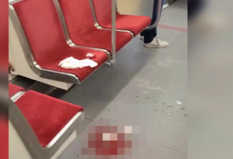 满地血！4名受害者在早高峰期的TTC地铁上遭一名女子袭击