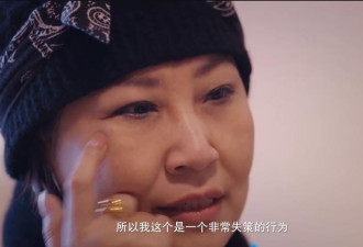 55岁歌手张蔷割双眼皮失败，对比明显