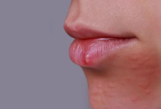 提醒：口腔出现5种现象 可能癌在打招呼