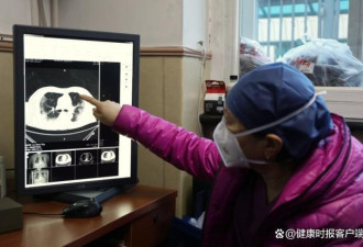 中国肺部CT检查暴增 专家：实际检出率约10%-20%