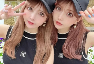 日本双胞胎姐妹砸4000万“换头”惊呆网友
