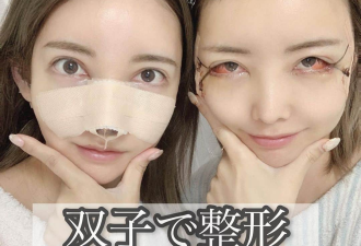 日本双胞胎姐妹砸4000万“换头”惊呆网友