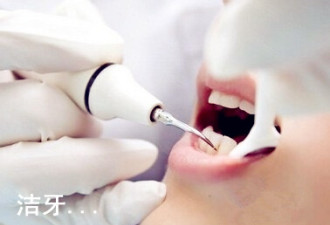 矫正期间如何控制牙菌斑？教你洁齿方法