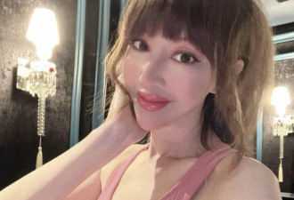 香港知名女星整容到走火入魔！患乳癌容貌大变...