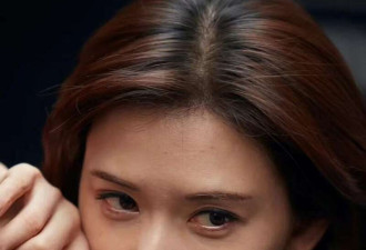林志玲家暴风波后晒图 满脸痘印皱纹黑眼圈明显