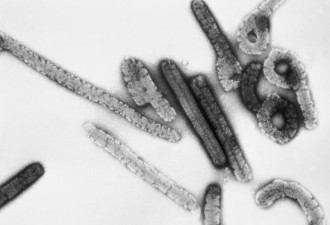 无药可医！马堡病毒现踪非洲坦桑尼亚至少5死