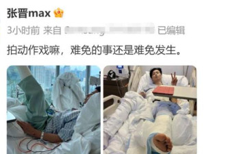 张晋拍戏受重伤住院 豪华病房插管吸氧