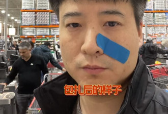 【视频】多伦多华人网友Costco勇拦劫匪受伤，却遭网友质疑
