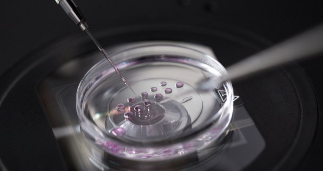 试管婴儿|体外受精- IVF Canada