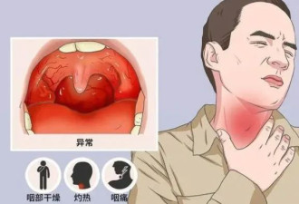 五一假期之后，全中国都在咽喉炎？