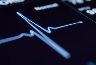 AI防猝死?人工智能可检测心脏病 准确率高达99.6%