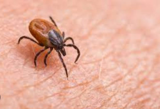夏日防护： 安省政府提醒居民采取预防措施，免受蜱虫叮咬！