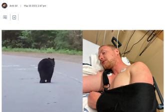 加拿大网红步道 男子骑车迎头撞上黑熊 当场吐血骨折
