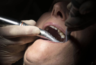 一次拔12颗牙 护士拒给止血药 男子血流整晚丧命