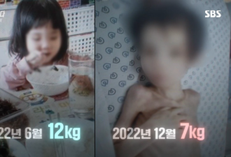 体重仅7kg！5岁女童惨遭虐待成活木乃伊