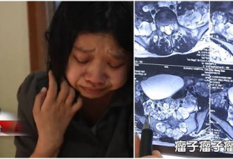22岁女长上千颗肿瘤 医:会在痛苦中死去