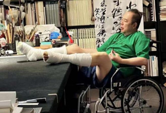 66岁张铁林紧急入院手术 双脚缠满绷带