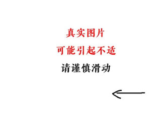 小心！因一条鱼，深圳男子遭截指、差点丧命