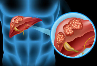 肝有500多种功能 肝病早期症状需重视