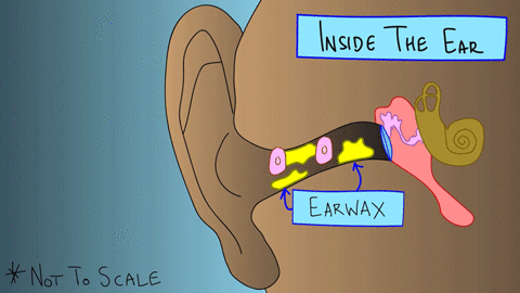 这5种耳朵需要定期“掏”，医生示范“采耳”
