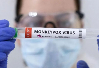 对抗猴痘的高危者：怕得病，更怕“社死”