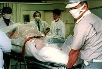 日本男子遭核辐射 亲眼看着自己融化而死