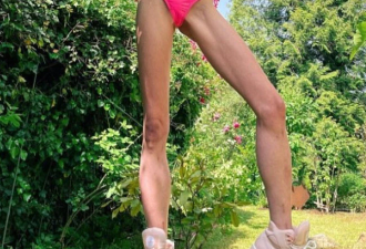 因丈夫喜欢大长腿，女模特砸120万断骨增高至1米8！