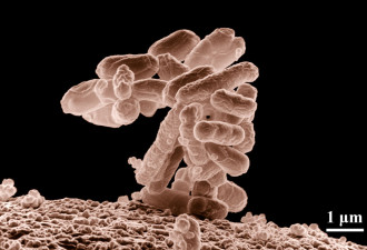 幼儿园爆大肠杆菌感染 50名学生送医