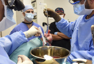 全球第2例猪心移植成功 拯救58岁退伍美军