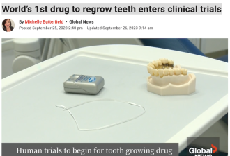 全球下个风口！成人牙齿再生药物 即将进入临床试验