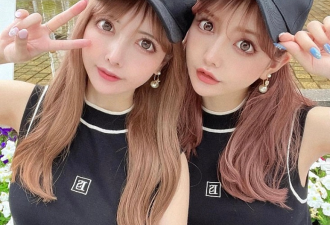 日本双胞胎网红自爆整容细节，全身动刀28次？！