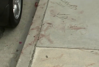 加州发生恐怖命案 女儿斩首母亲 头颅扔垃圾桶！