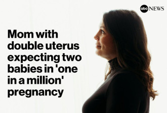 美国女子天生有两个子宫 还刚好“都怀孕” 医生惊呼奇迹