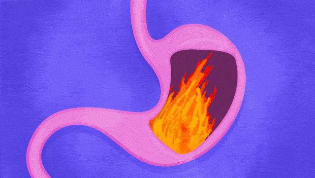 胃病变成“胃癌”前，曾用5个症状提醒你