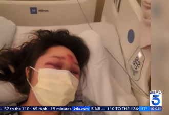可怕！37岁华人女子在Costco遇袭：惨遭殴打+拖行数十米！