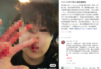 中国留学生血溅街头 和妈妈打电话时遭子弹击中脑门 满手满脸鲜血