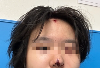 中国留学生血溅街头 和妈妈打电话时遭子弹击中脑门 满手满脸鲜血