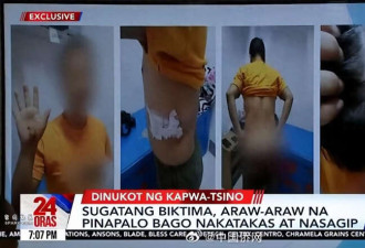 中国男子菲律宾遭绑架勒索并毒打,被威胁卖器官