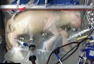 美人造子宫有望进入人体试验 成功孕育小羊羔