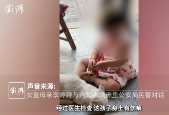 河北2岁女童送医后死亡，其父已被刑拘