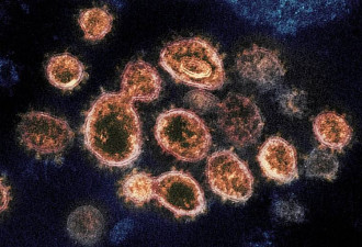 世卫组织呼吁各国小心“X疾病”，致命率高