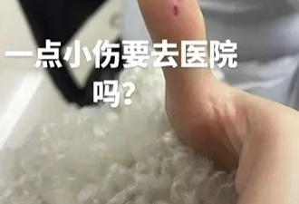 西安女子手指遭竹筷刺伤送医 医药费吃惊