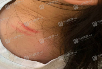 中国女留学生在澳乘公车遇种袭，遭恶少群起围攻！