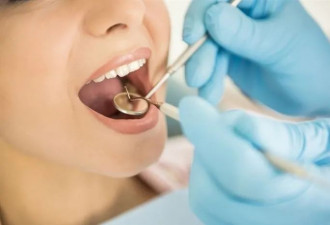 一次看牙22颗牙齿被治疗！BC女子获赔1.5万