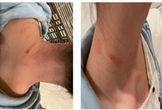 华人亿万富豪覃辉认罪！吊销绿卡 驱逐出美 凶器曝光