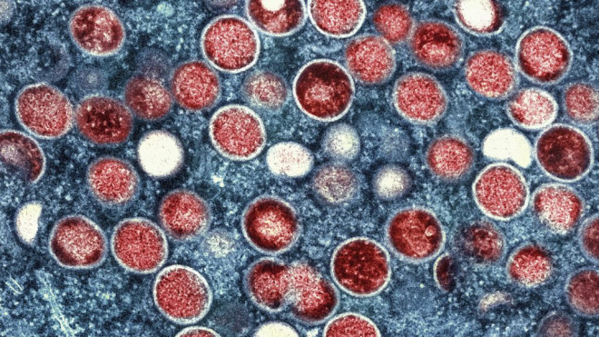 This colorized electron microscope image provided by the National Institute of Allergy and Infectious Diseases shows mpox particles