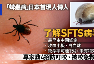 日本现首例“人传人蜱虫病” 4招减叮咬机会