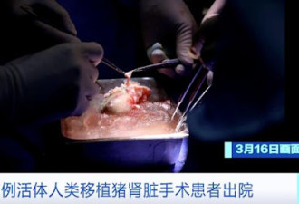 全球首例活体人类移植猪肾脏手术患者，出院了！