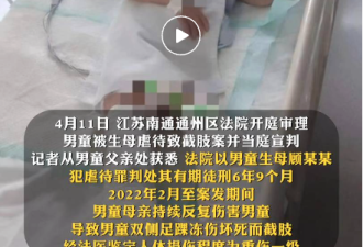 江苏5岁男童遭生母虐待 惨遭截肢 一审宣判了