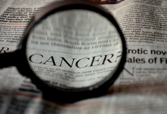 全球青年人癌症发病增高 问题出在哪儿？